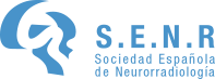 SENR: Bienvenid@ al portal de la SENR (Sociedad Española de Neurorradiología)