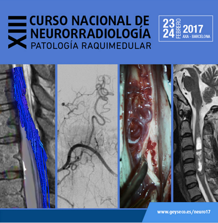 Curso Nacional de Neurorradiología