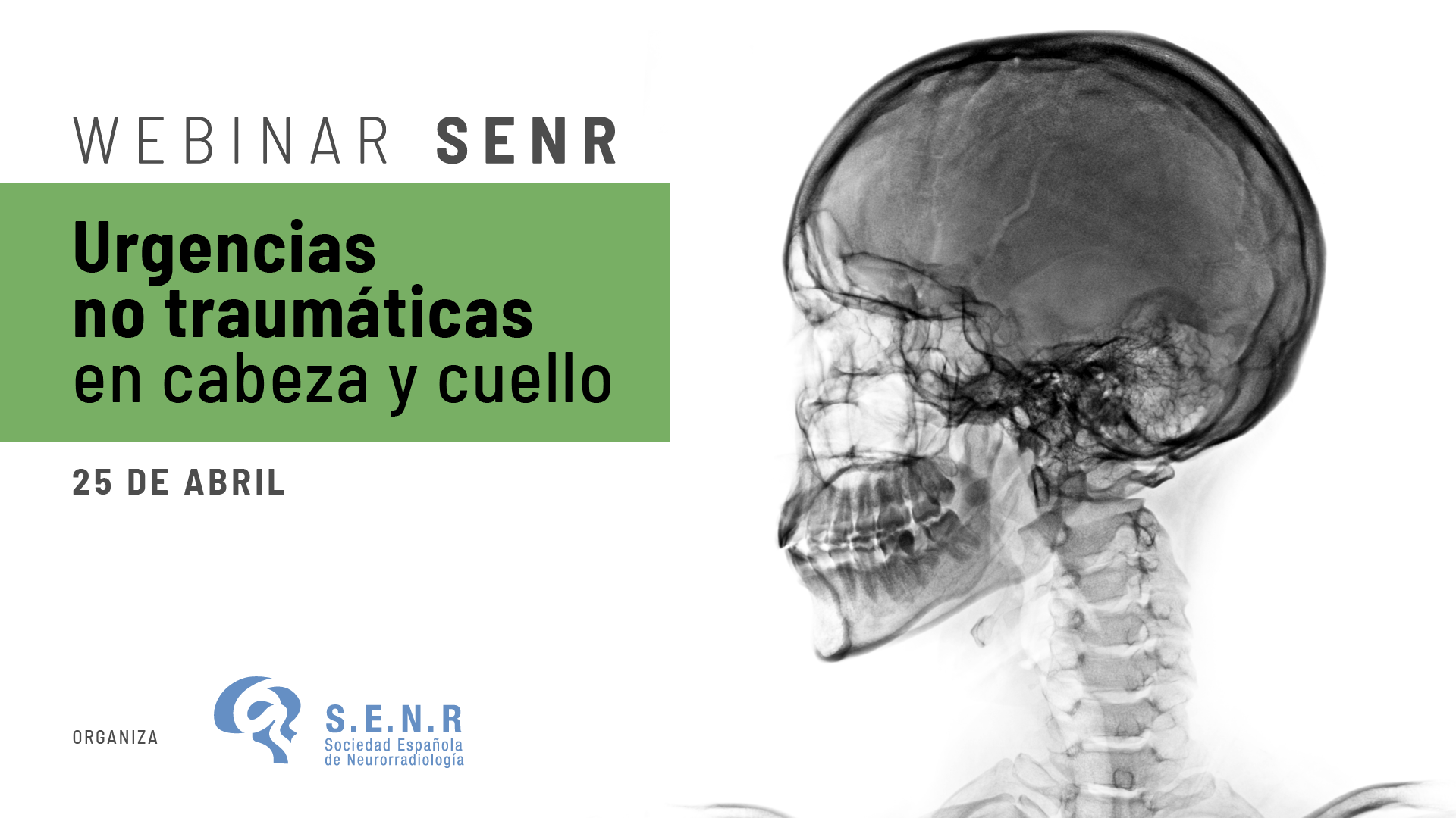 SENR webinar