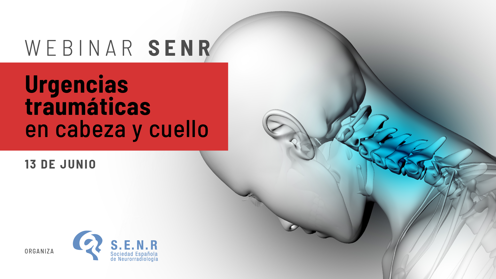 SENR webinar