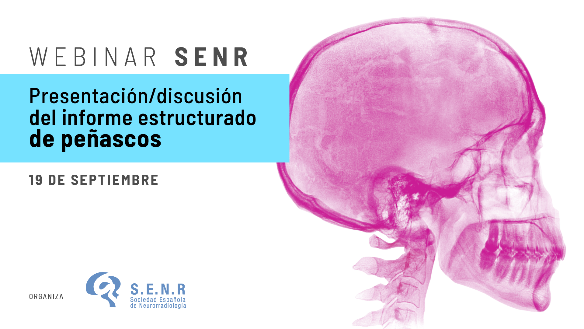 SENR_webinar_03