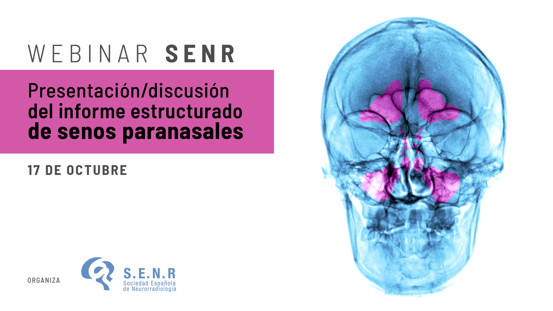 SENR webinar