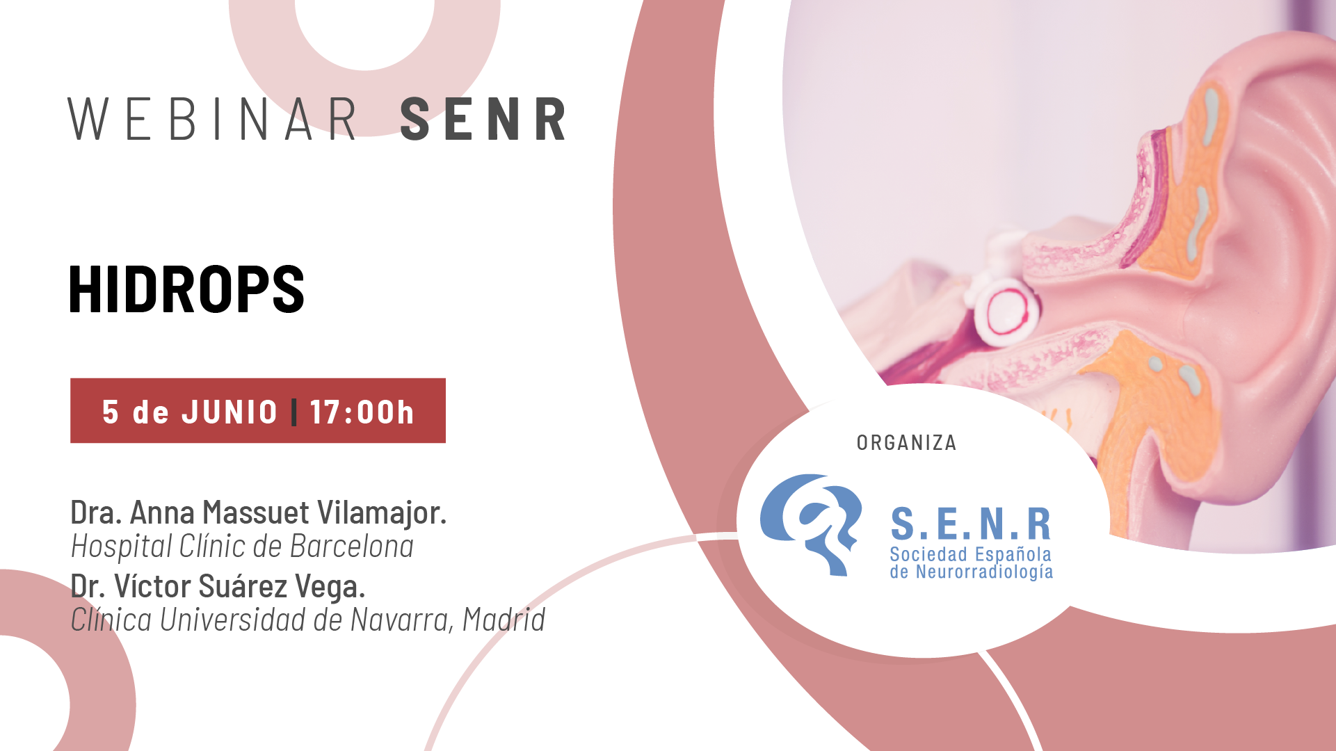 SENR_webinar_02